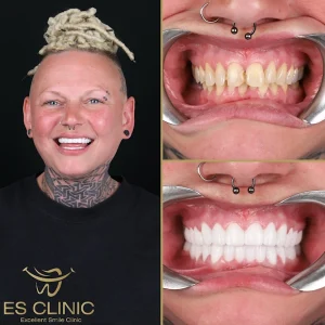 ES CLINIC KONYAALTI ANTALYA INSTAGRAM 07