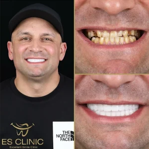 ES CLINIC KONYAALTI ANTALYA INSTAGRAM 08