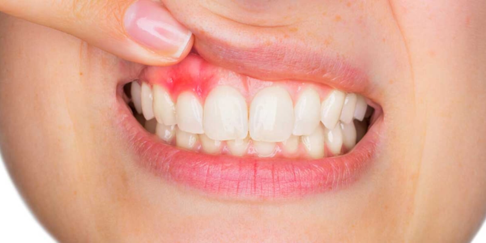 periodontoloji-1600
